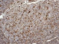 Immunohistochemistry (Formalin/PFA-fixed paraffin-embedded sections) - Anti-DcR2 antibody [EPR3588(2)] (AB108421)