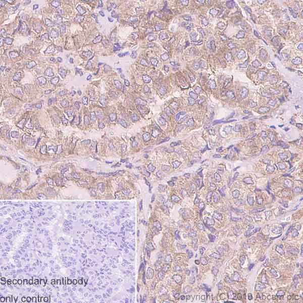 Immunohistochemistry (Formalin/PFA-fixed paraffin-embedded sections) - Anti-DcR2 antibody [EPR3588(2)] (AB108421)