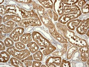 Immunohistochemistry (Formalin/PFA-fixed paraffin-embedded sections) - Anti-DcR2 antibody [EPR3588(2)] (AB108421)