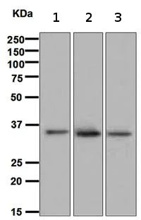 Western blot - Anti-DcR2 antibody [EPR3588(2)] (AB108421)