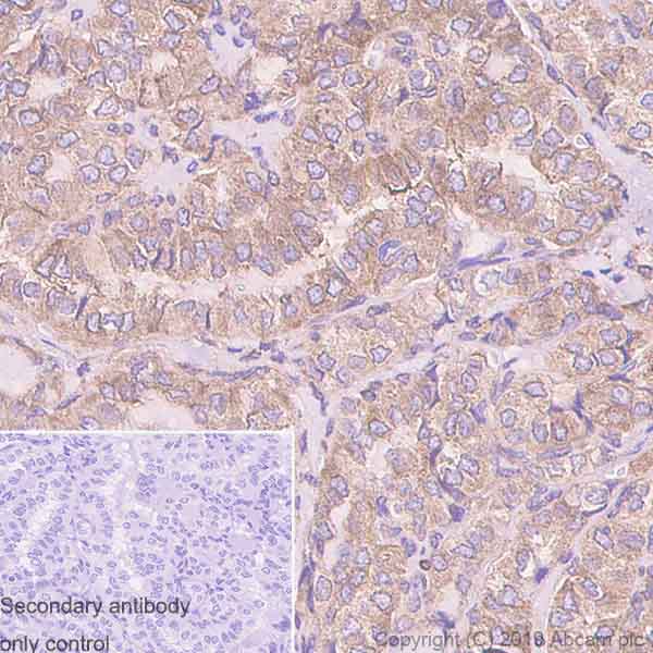 Immunohistochemistry (Formalin/PFA-fixed paraffin-embedded sections) - Anti-DcR2 antibody [EPR3588(2)] - BSA and Azide free (AB247666)