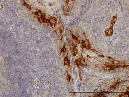 Immunohistochemistry (Formalin/PFA-fixed paraffin-embedded sections) - Anti-DcR3 antibody [7G5] (AB57956), expandable thumbnail