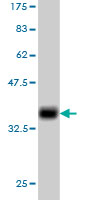 Western blot - Anti-DcR3 antibody [7G5] (AB57956), expandable thumbnail