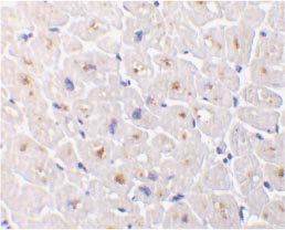 Immunohistochemistry (Formalin/PFA-fixed paraffin-embedded sections) - Anti-DcR3 antibody (AB8405)