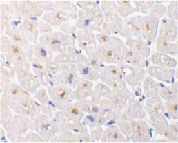 Immunohistochemistry (Formalin/PFA-fixed paraffin-embedded sections) - Anti-DcR3 antibody (AB8405)
