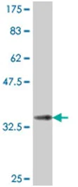 Western blot - Anti-DCST1 antibody (AB194559)