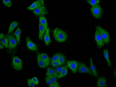 Immunocytochemistry/ Immunofluorescence - Anti-DCSTAMP antibody (AB238151)