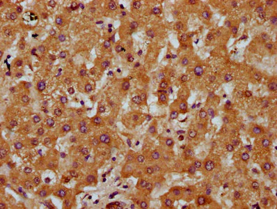 Immunohistochemistry (Formalin/PFA-fixed paraffin-embedded sections) - Anti-DCSTAMP antibody (AB238151)