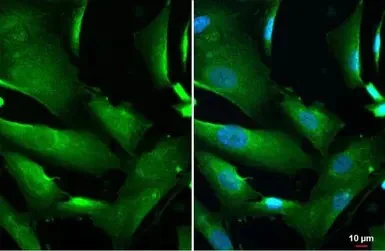 Immunocytochemistry/ Immunofluorescence - Anti-DCTD antibody (AB183607)
