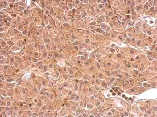 Immunohistochemistry (Formalin/PFA-fixed paraffin-embedded sections) - Anti-DCTD antibody (AB183607)