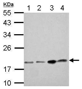 Western blot - Anti-DCTD antibody (AB183607)
