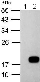 Western blot - Anti-DCTD antibody (AB183607)
