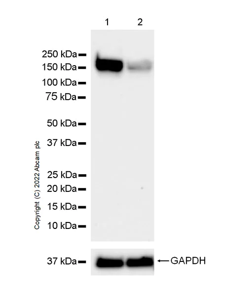 Western blot - Anti-DCTN1/p150-glued antibody [12/P150GLUED] (AB302964)