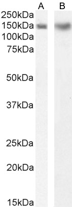 Western blot - Anti-DCTN1/p150-glued antibody (AB11806)