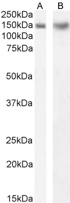 Western blot - Anti-DCTN1/p150-glued antibody (AB11806)
