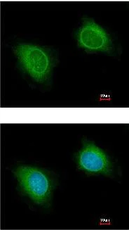 Immunocytochemistry/ Immunofluorescence - Anti-DCTN1/p150-glued antibody (AB96004)