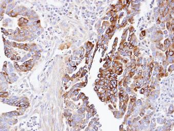 Immunohistochemistry (Formalin/PFA-fixed paraffin-embedded sections) - Anti-DCTN1/p150-glued antibody (ab96004), expandable thumbnail