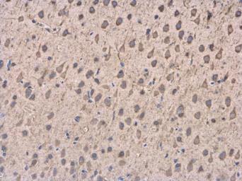 Immunohistochemistry (Formalin/PFA-fixed paraffin-embedded sections) - Anti-DCTN1/p150-glued antibody (AB96004), expandable thumbnail