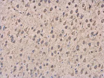 Immunohistochemistry (Formalin/PFA-fixed paraffin-embedded sections) - Anti-DCTN1/p150-glued antibody (AB96004)