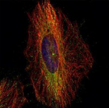 Immunohistochemistry (Formalin/PFA-fixed paraffin-embedded sections) - Anti-DCTN1/p150-glued antibody (ab96004), expandable thumbnail