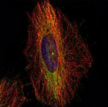 Immunohistochemistry (Formalin/PFA-fixed paraffin-embedded sections) - Anti-DCTN1/p150-glued antibody (AB96004)