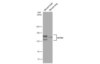 Western blot - Anti-DCTN1/p150-glued antibody (AB96004)