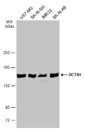 Western blot - Anti-DCTN1/p150-glued antibody (AB96004), expandable thumbnail
