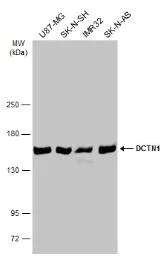 Western blot - Anti-DCTN1/p150-glued antibody (AB96004)