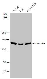 Western blot - Anti-DCTN1/p150-glued antibody (AB96004), expandable thumbnail