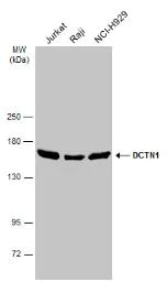 Western blot - Anti-DCTN1/p150-glued antibody (AB96004)