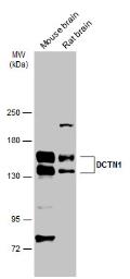 Western blot - Anti-DCTN1/p150-glued antibody (AB96004), expandable thumbnail