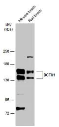 Western blot - Anti-DCTN1/p150-glued antibody (AB96004)