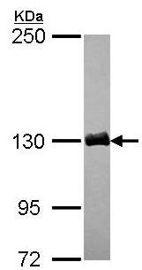 Western blot - Anti-DCTN1/p150-glued antibody (ab96004), expandable thumbnail