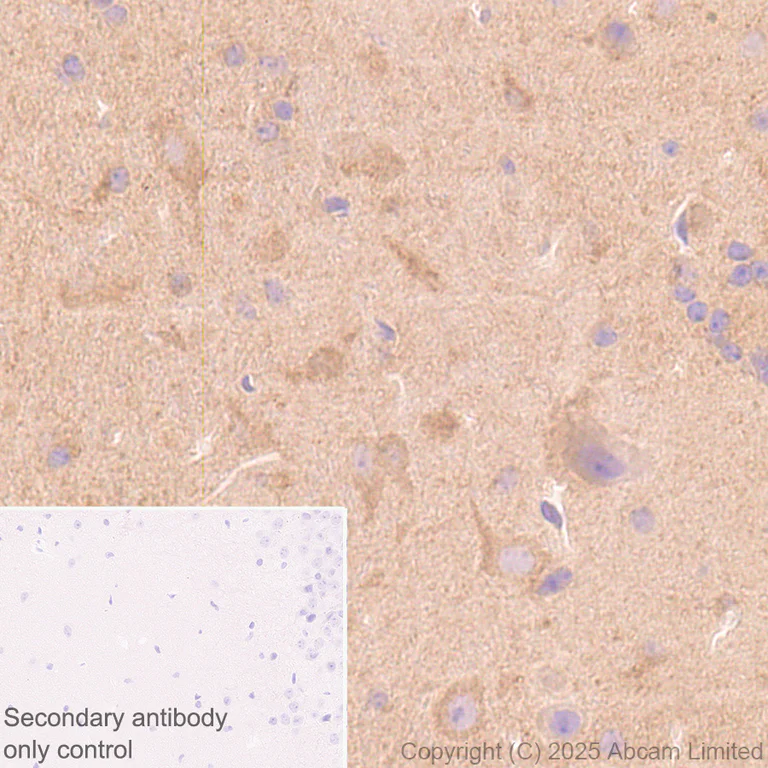 Immunohistochemistry (Formalin/PFA-fixed paraffin-embedded sections) - Anti-DCTN1/p150-glued antibody [EPR26464-28] (AB302629)