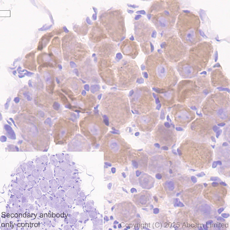 Immunohistochemistry (Formalin/PFA-fixed paraffin-embedded sections) - Anti-DCTN1/p150-glued antibody [EPR26464-28] (AB302629)