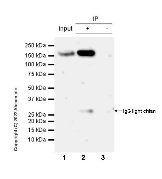 Immunoprecipitation - Anti-DCTN1/p150-glued antibody [EPR26464-28] (ab302629), expandable thumbnail