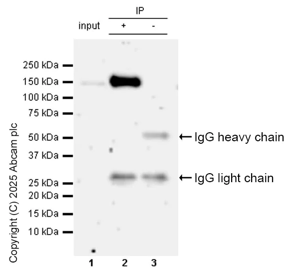Immunoprecipitation - Anti-DCTN1/p150-glued antibody [EPR26464-28] (AB302629)