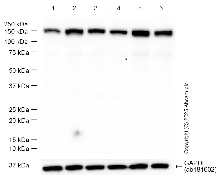 Western blot - Anti-DCTN1/p150-glued antibody [EPR26464-28] (AB302629)