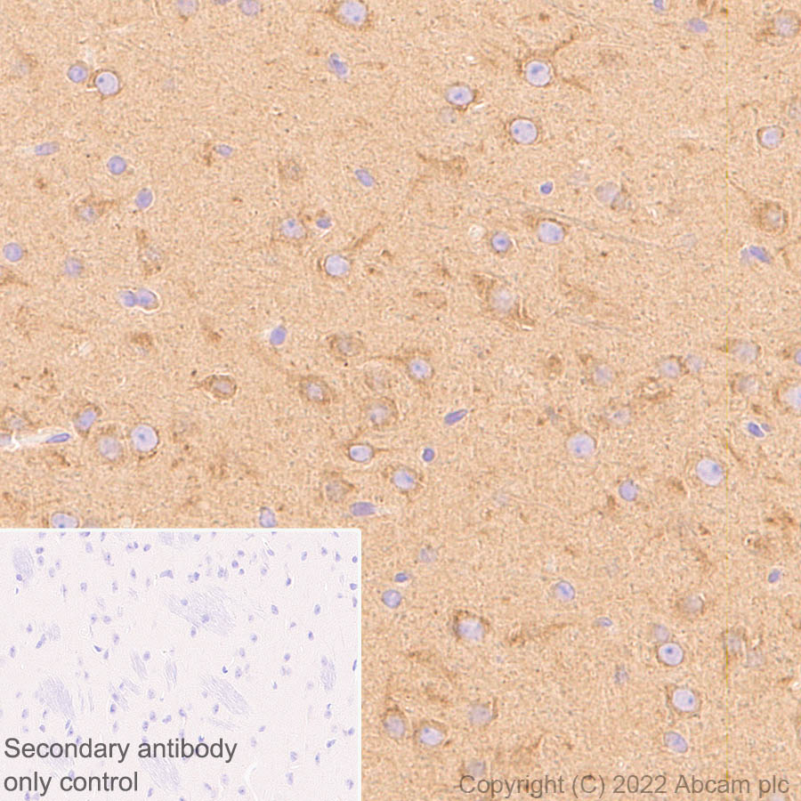 Immunohistochemistry (Formalin/PFA-fixed paraffin-embedded sections) - Anti-DCTN1/p150-glued antibody [EPR26464-28] (BSA and Azide free) (ab302630), expandable thumbnail