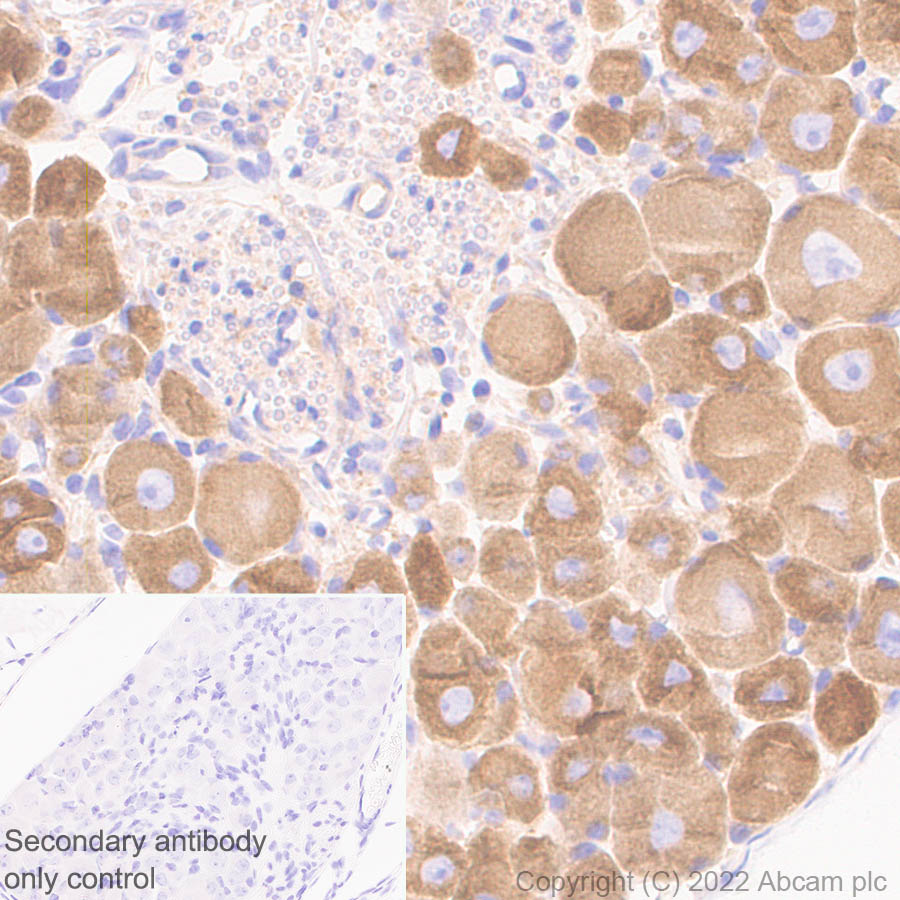 Immunohistochemistry (Formalin/PFA-fixed paraffin-embedded sections) - Anti-DCTN1/p150-glued antibody [EPR26464-28] (BSA and Azide free) (ab302630), expandable thumbnail