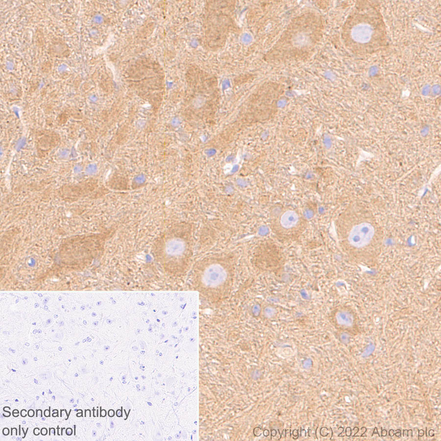 Immunohistochemistry (Formalin/PFA-fixed paraffin-embedded sections) - Anti-DCTN1/p150-glued antibody [EPR26464-28] (BSA and Azide free) (AB302630), expandable thumbnail