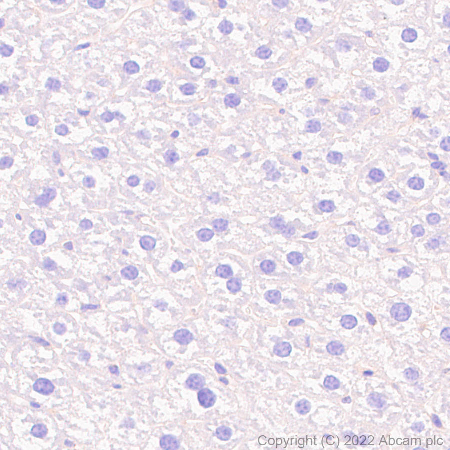 Immunohistochemistry (Formalin/PFA-fixed paraffin-embedded sections) - Anti-DCTN1/p150-glued antibody [EPR26464-28] (BSA and Azide free) (AB302630), expandable thumbnail