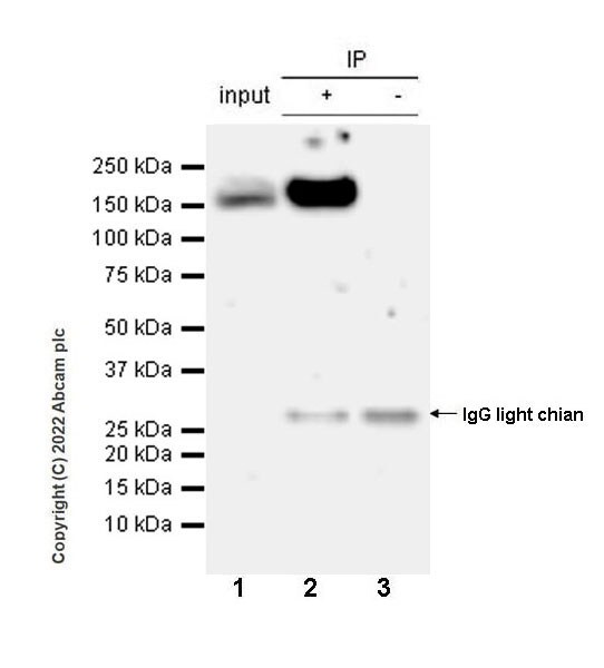 Immunoprecipitation - Anti-DCTN1/p150-glued antibody [EPR26464-28] (BSA and Azide free) (ab302630), expandable thumbnail