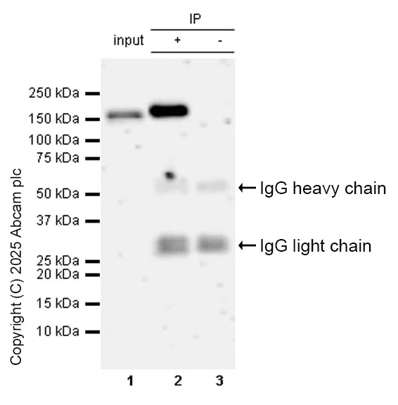 Immunoprecipitation - Anti-DCTN1/p150-glued antibody [EPR26464-28] (BSA and Azide free) (AB302630)