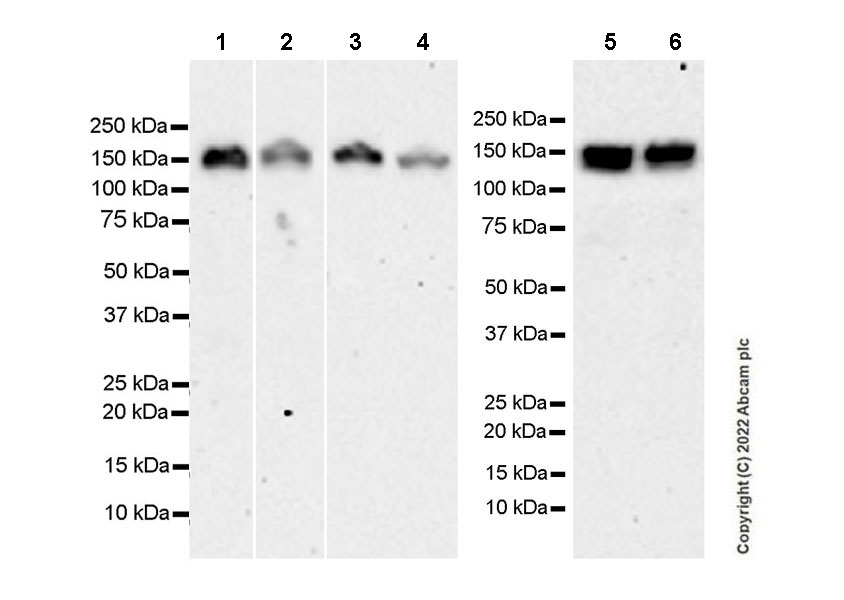Western blot - Anti-DCTN1/p150-glued antibody [EPR26464-28] (BSA and Azide free) (ab302630), expandable thumbnail
