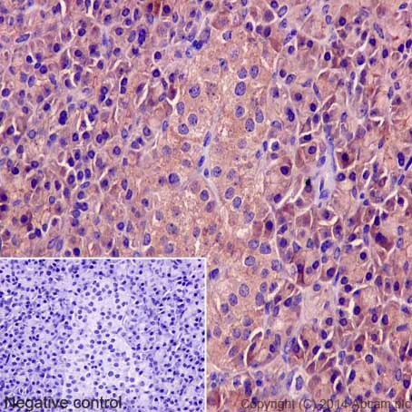 Immunohistochemistry (Formalin/PFA-fixed paraffin-embedded sections) - Anti-DCTN3 antibody [EPR5097] (AB124674)