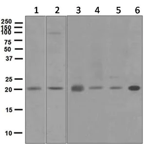 Western blot - Anti-DCTN3 antibody [EPR5097] (AB124674)