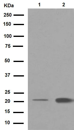 Western blot - Anti-DCTN3 antibody [EPR5097] (AB124674)