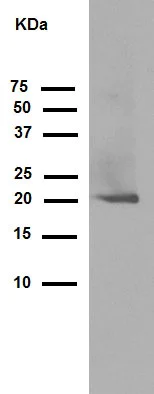 Western blot - Anti-DCTN3 antibody [EPR5097] (AB124674)