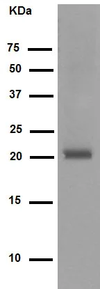 Western blot - Anti-DCTN3 antibody [EPR5097] (AB124674)